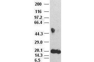 IL-6 antibody (3G9) at 1:500000 + recombinant human IL-6 (IL-6 antibody  (AA 29-212))