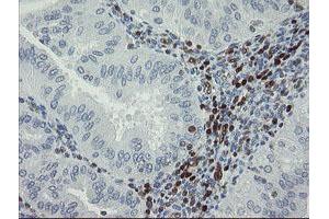 Image no. 1 for anti-GTPase, IMAP Family Member 4 (GIMAP4) antibody (ABIN1498460) (GIMAP4 antibody)
