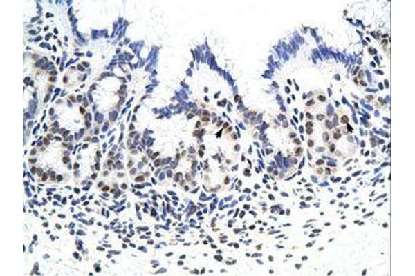 Zinc Finger Protein 296 (ZNF296) (C-Term) 抗体