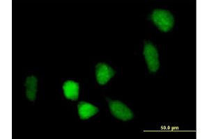 Immunofluorescence of purified MaxPab antibody to BCOR on HeLa cell. (BCOR antibody  (AA 1-1004))