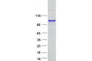 Validation with Western Blot