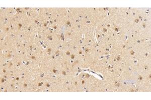 Immunohistochemistry (IHC) image for anti-Phosphoinositide-3-Kinase, Catalytic, beta Polypeptide (PIK3CB) (AA 524-703) antibody (ABIN7436744)