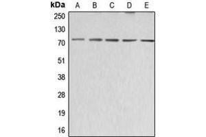 Western blot analysis of ABCG2 expression in HeLa (A), SP2/0 (B), H9C2 (C), HEK293T (D), HepG2 (E) whole cell lysates. (ABCG2 antibody  (Center))