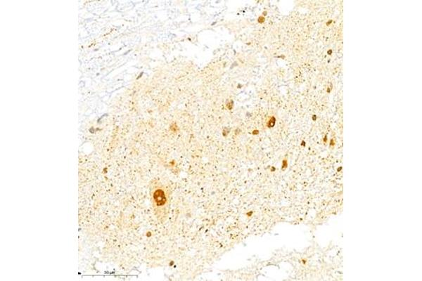 FGF11 antibody
