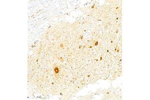 Immunohistochemistry of paraffin embedded rat spinal cord using FGF11 (ABIN7073941) at dilution of 1:2200 (400x lens)