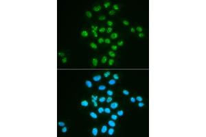 Immunofluorescence (IF) image for anti-BMI1 Polycomb Ring Finger Oncogene (BMI1) (AA 120-326) antibody (ABIN3020691)