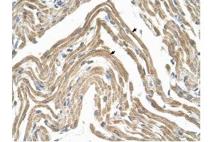 CCBP2 antibody was used for immunohistochemistry at a concentration of 4-8 ug/ml to stain Skeletal muscle cells (arrows) in Human Muscle. (CCBP2 antibody  (N-Term))