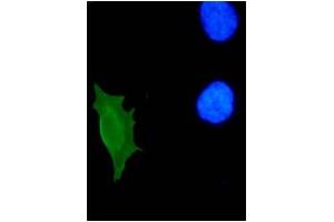 IF analysis of HPV-11 E7 protein in U2OS cells. (Human Papilloma Virus 11 E7 (HPV-11 E7) (AA 36-70) antibody)