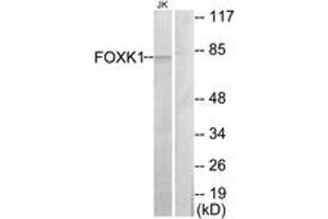 Western blot analysis of extracts from Jurkat cells, using FOXK1 Antibody. (Foxk1 antibody  (AA 681-730))