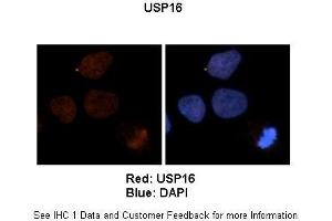 Sample Type :  Human brain stem cells (NT2)   Primary Antibody Dilution :   1:500  Secondary Antibody :  Goat anti-rabbit Alexa Fluor 594  Secondary Antibody Dilution :   1:1000  Color/Signal Descriptions :  Red: USBlue: DAPI  Gene Name :  US Submitted by :  Dr. (USP16 antibody  (N-Term))