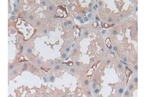 P-Selectin antibody  (AA 198-432)
