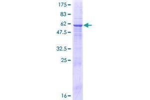 Image no. 1 for Calcyphosine 2 (CAPS2) (AA 1-293) protein (GST tag) (ABIN1348014) (Calcyphosine 2 Protein (CAPS2) (AA 1-293) (GST tag))