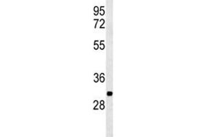 Western blot analysis of PGP antibody and K562 lysate (PGP antibody  (AA 33-62))
