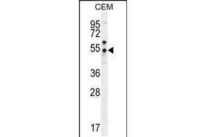 Western blot analysis in CEM cell line lysates (35ug/lane). (FOLH1B antibody  (C-Term))