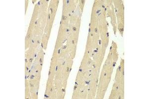 Immunohistochemistry of paraffin-embedded mouse heart using USP7 antibody (ABIN6293331) at dilution of 1:200 (40x lens).