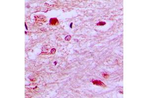 Immunohistochemical analysis of E2F6 staining in human brain formalin fixed paraffin embedded tissue section.