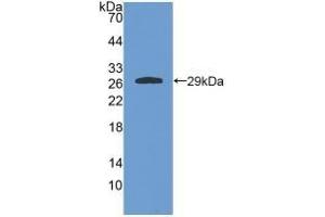 Detection of Recombinant GSTa4, Rat using Polyclonal Antibody to Glutathione S Transferase A4 (GSTA4) (GSTA4 antibody  (AA 2-222))