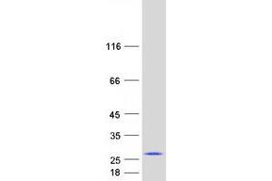 Validation with Western Blot (CBX3 Protein (Transcript Variant 2) (Myc-DYKDDDDK Tag))