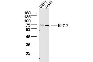 Lane 1: U251 lysates Lane 2: A549 lysates probed with KLC2 Polyclonal Antibody, Unconjugated  at 1:300 dilution and 4˚C overnight incubation. (KLC2 antibody  (AA 51-150))