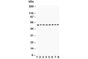 Western blot testing of Beclin 1 antibody and Lane 1:  COLO320 (Beclin 1 antibody  (AA 1-354))