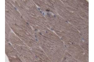 Detection of CKM in Porcine Skeletal muscle Tissue using Polyclonal Antibody to Creatine Kinase, Muscle (CKM) (CKM antibody  (AA 11-367))