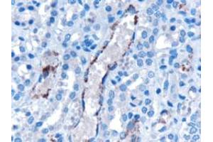 Immunohistochemistry (IHC) image for anti-Vacuolar Protein-Sorting-Associated Protein 25 (VPS25) (Internal Region) antibody (ABIN185544)