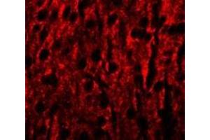 Immunofluorescence of RILPL1 in mouse brain cells with RILPL1 antibody at 20 ug/mL. (RILPL1 antibody  (N-Term))
