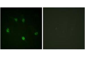 Immunofluorescence analysis of HeLa cells, using Cyclin E1 (Ab-77) Antibody. (Cyclin E1 antibody  (AA 43-92))
