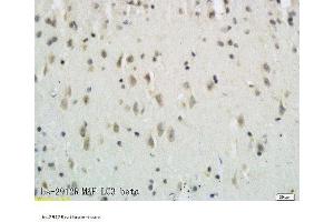Formalin-fixed and paraffin embedded rat brain tissue labeled with Anti-LC3B/MAP LC3β/MAP1A Polyclonal Antibody, Unconjugated  followed by conjugation to the secondary antibody and DAB staining (MAP1LC3A/B antibody  (AA 21-121))