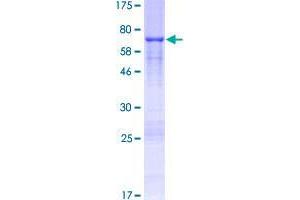 Image no. 1 for DKK3 (AA 1-350) protein (GST tag) (ABIN1351651) (DKK3 Protein (AA 1-350) (GST tag))