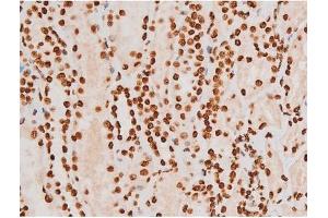 Immunohistochemistry (IHC) image for anti-REL proto-oncogene (c-Rel) (pSer503) antibody (ABIN6255382)