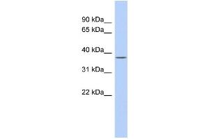 WB Suggested Anti-SIRT6 Antibody Titration:  0. (SIRT6 antibody  (Middle Region))