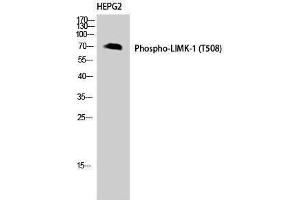 Western Blotting (WB) image for anti-LIM Domain Kinase 1 (LIMK1) (pThr508) antibody (ABIN3182060) (LIM Domain Kinase 1 antibody  (pThr508))