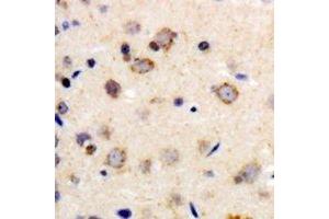 Immunohistochemical analysis of Beta-1 Adrenergic Receptor staining in human brain formalin fixed paraffin embedded tissue section. (ADRB1 antibody)