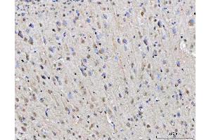 IHC analysis of RGS12 using anti-RGS12 antibody (ABIN7602410).