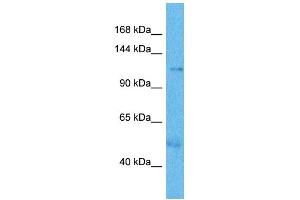 Host:  Rabbit  Target Name:  UTY  Sample Type:  Thyroid Tumor lysates  Antibody Dilution:  1. (UTY antibody  (N-Term))