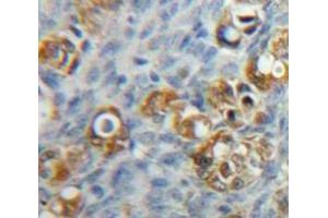 #VALUE! (F11R antibody  (AA 64-249))