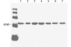 Image no. 1 for anti-Actin, beta (ACTB) antibody (ABIN2614157) (beta Actin antibody)