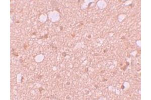 Immunohistochemistry (IHC) image for anti-SEC14 and Spectrin Domains 1 (SESTD1) (C-Term) antibody (ABIN1030653)