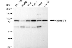 Western blotting analysis using catenin beta 1 antibody (ABIN7797930). (CTNNB1 antibody)