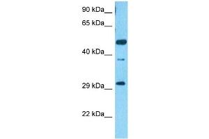 Host:  Rabbit  Target Name:  SCRT2  Sample Type:  HCT116 Whole Cell lysates  Antibody Dilution:  1. (SCRT2 antibody  (N-Term))