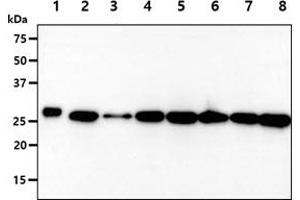 The recombinant protein (50ng) and cell lysates (40ug) were resolved by SDS-PAGE, transferred to PVDF membrane and probed with anti-human PGAM2 antibody (1:1000). (PGAM2 antibody)