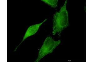 Immunofluorescence of monoclonal antibody to SEPT8 on HeLa cell.