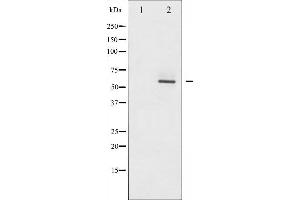 Western blot analysis of Akt2 phosphorylation expression in TNF-α treated A2780 whole cell lysates,The lane on the left is treated with the antigen-specific peptide. (AKT2 antibody  (pSer474))
