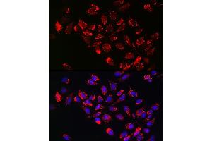 Immunofluorescence analysis of U-2 OS cells using [KO Validated] Hexokinase II Rabbit pAb (ABIN3021255, ABIN3021256, ABIN3021257 and ABIN6214088) at dilution of 1:100 (40x lens). (Hexokinase 2 antibody  (AA 1-120))