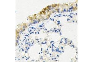 Immunohistochemical analysis of KIF2B staining in mouse lung formalin fixed paraffin embedded tissue section. (KIF2B antibody)