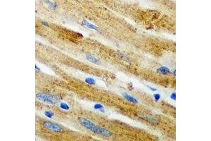 Immunohistochemical analysis of CARS staining in mouse heart formalin fixed paraffin embedded tissue section. (CARS antibody)