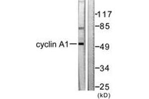 Western blot analysis of extracts from SKOV3 cells, using Cyclin A1 Antibody. (Cyclin A1 antibody  (AA 411-460))