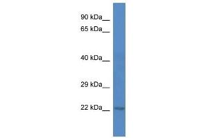 Western Blot showing 5730409E04Rik antibody used at a concentration of 1. (C1ORF216 antibody  (C-Term))