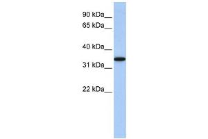 Western Blotting (WB) image for anti-ADP-Ribosyltransferase 4 (Dombrock Blood Group) (ART4) antibody (ABIN2458668) (ART4 antibody)